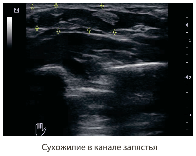 визуализация аппарата