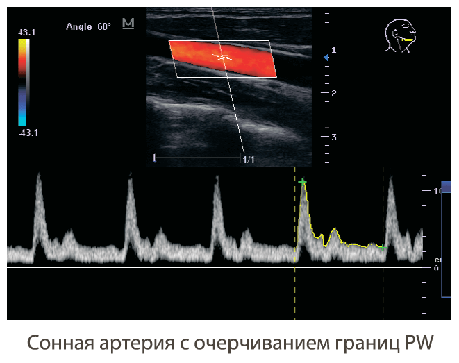 визуализация аппарата