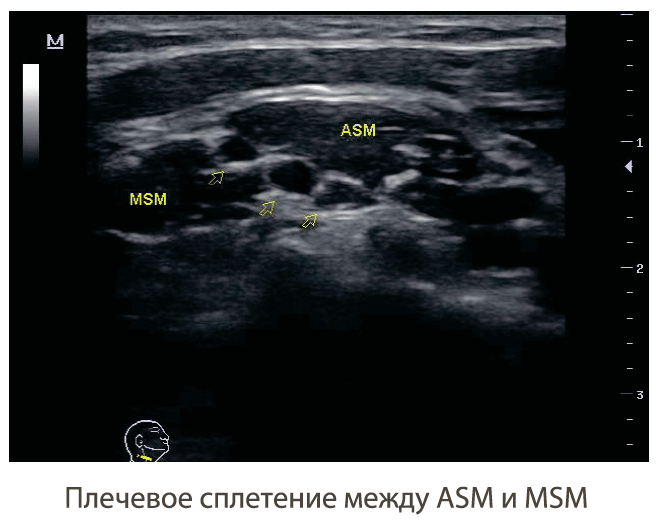 визуализация аппарата