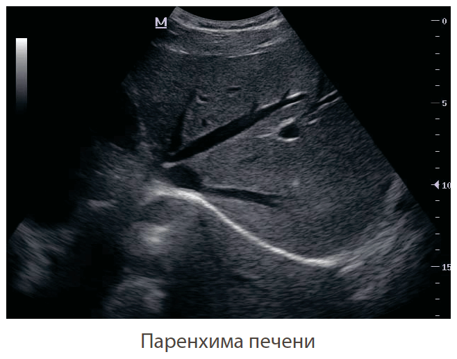 визуализация аппарата