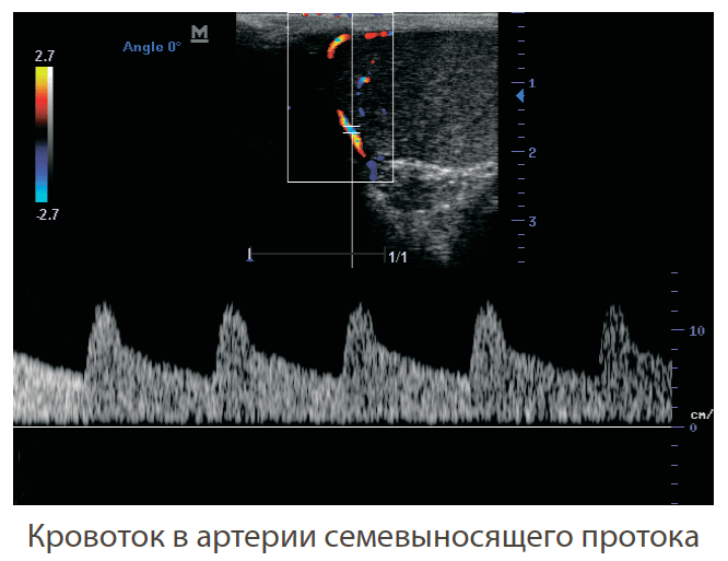 визуализация аппарата