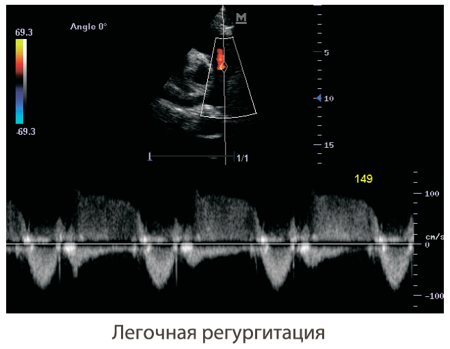 визуализация аппарата