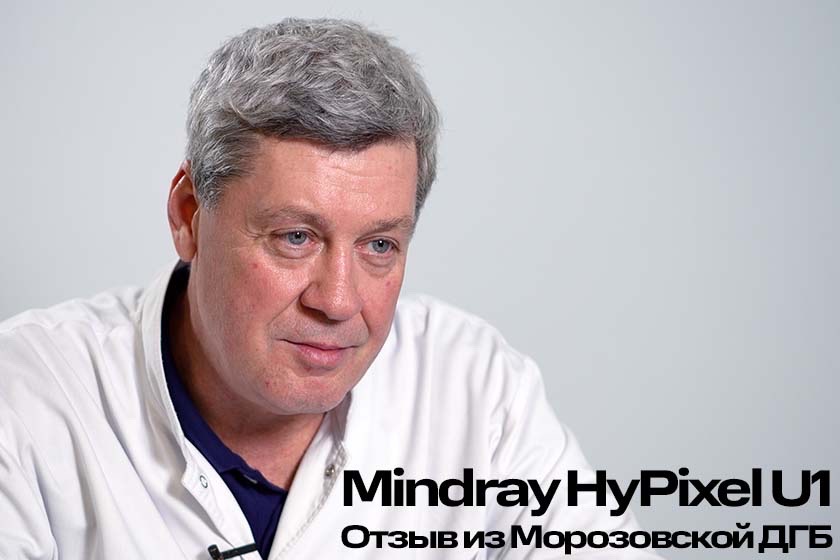 Отзыв об эндоскопической стойке Mindray HyPixel U1