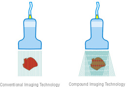 Описание технологии многолучевого составного сканирования (компаундинг)